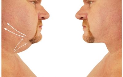 How to Lose Face Fat: Complete, No BS Guide