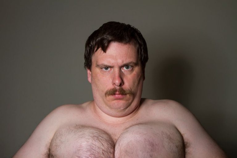 get-rid-of-chest-fat-768x512.jpg