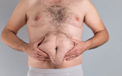 Soft Belly Fat One of The Most Demoralising Signs Of Weight Loss Progress